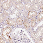 Immunohistochemical staining of human kidney shows moderate cytoplasmic positivity in cells in tubules.