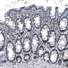 Immunohistochemical staining of human gastrointestinal shows weak to moderate nuclear positivity in lymphoid cells.