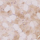 Immunohistochemical staining of human skeletal muscle shows moderate cytoplasmic positivity in myocytes.
