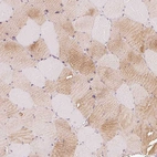Immunohistochemical staining of human skeletal muscle shows moderate cytoplasmic positivity in myocytes.