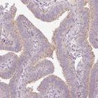 Immunohistochemical staining of human fallopian tube shows moderate positivity in cilia in glandular cells.