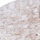 Immunohistochemical staining of human skeletal muscle shows no positivity in myocytes as expected.
