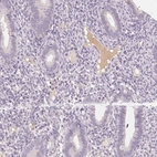 Immunohistochemical staining of human endometrium shows moderate positivity in plasma.