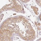 Immunohistochemical staining of human testis shows moderate cytoplasmic positivity in cells in seminiferous ducts.