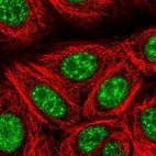 Immunofluorescent staining of human cell line MCF7 shows localization to nuclear speckles.