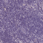 Anti-RNF167 Antibody