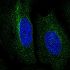 Immunofluorescent staining of human cell line HeLa shows localization to cytosol.