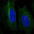 Immunofluorescent staining of human cell line HeLa shows localization to cytosol.
