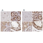 Anti-PSMD7 Antibody
