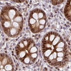 Immunohistochemical staining of human colon using Anti-PSMD7 antibody HPA049824.