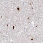 Immunohistochemical staining of human cerebral cortex using Anti-PSMD7 antibody HPA049824.
