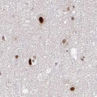 Immunohistochemical staining of human cerebral cortex using Anti-PSMD7 antibody HPA049824.