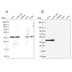Western blot analysis using Anti-PSMD7 antibody HPA049824 (A) shows similar pattern to independent antibody HPA056069 (B).