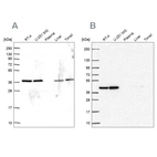 Western blot analysis using Anti-PSMD7 antibody HPA049824 (A) shows similar pattern to independent antibody HPA056069 (B).