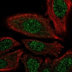 Immunofluorescent staining of human cell line PC-3 shows localization to nucleoplasm.