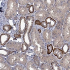 Immunohistochemical staining of human kidney shows moderate membranous and cytoplasmic positivity in cells in tubules.