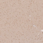 Immunohistochemical staining of human cerebral cortex shows moderate nuclear and cytoplasmic positivity in neuronal cells.