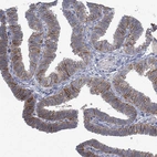 Immunohistochemical staining of human fallopian tube shows moderate membranous positivity in glandular cells.