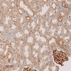 Immunohistochemical staining of human kidney shows moderate nucleus positivity in cells in tubules.