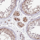 Immunohistochemical staining of human testis shows moderate nuclear positivity in Leydig cells and cells in seminiferous ducts.