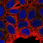 Immunofluorescent staining of human cell line RT4 shows localization to vesicles.