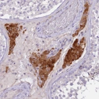 Immunohistochemical staining of human testis shows moderate cytoplasmic positivity in Leydig cells.