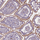 Immunohistochemical staining of human small intestine shows moderate positivity in apical membrane in glandular cells.