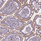 Immunohistochemical staining of human small intestine shows moderate positivity in apical membrane in glandular cells.