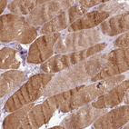 Immunohistochemical staining of human skeletal muscle moderate cytoplasmic positivity in myocytes.
