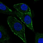 Immunofluorescent staining of human cell line A549 shows localization to vesicles.