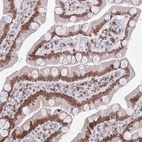 Immunohistochemical staining of human small intestine shows strong positivity in nuclear membrane in glandular cells.