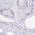Immunohistochemical staining of human testis shows strong positivity in nuclear membrane in subset of cells in seminiferous ducts.