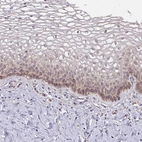 Immunohistochemical staining of human cervix, uterine shows weak membranous/cytoplasmic positivity in squamous epithelial cells.
