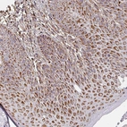 Immunohistochemical staining of human skin shows strong granular cytoplasmic positivity in squamous epithelial cells.