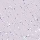 Immunohistochemical staining of human skeletal muscle shows no positivity in myocytes as expected.