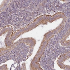 Immunohistochemical staining of human endometrium shows moderate to strong cytoplasmic positivity in glandular cells.
