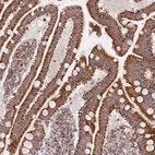 Immunohistochemical staining of human duodenum shows strong granular cytoplasmic positvity in glandular cells.