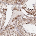 Immunohistochemical staining of human testis shows strong granular cytoplasmic positivity in Leydig cells and Sertoli cells.