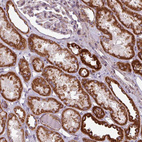 Immunohistochemical staining of human kidney shows strong positivity in cells in tubules.