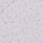 Immunohistochemical staining of human skeletal muscle shows no positivity in myocytes.