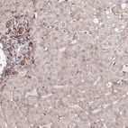 Immunohistochemical staining of human liver shows moderate granular cytoplasmic positivity in bile duct cells and hepatocytes.