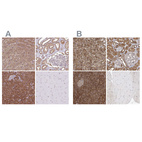 Immunohistochemical staining of human adrenal gland, kidney, pancreas and skeletal muscle using Anti-PACSIN2 antibody HPA049854 (A) shows similar protein distribution across tissues to independent antibody HPA056520 (B).