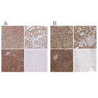 Immunohistochemical staining of human adrenal gland, kidney, pancreas and skeletal muscle using Anti-PACSIN2 antibody HPA049854 (A) shows similar protein distribution across tissues to independent antibody HPA056520 (B).