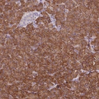 Immunohistochemical staining of human pancreas shows strong cytoplasmic positivity in exocrine glandular cells.