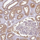 Immunohistochemical staining of human kidney shows weak to moderate cytoplasmic positivity in cells in tubules.