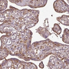 Immunohistochemical staining of human placenta shows weak to moderate cytoplasmic positivity in trophoblastic cells.