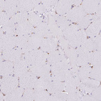 Immunohistochemical staining of human skeletal muscle shows no positivity in myocytes as expected.