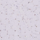 Immunohistochemical staining of human skeletal muscle shows no positivity in myocytes as expected.