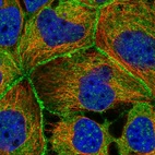 Immunofluorescent staining of human cell line CACO-2 shows localization to nuclear speckles, plasma membrane, cytosol & vesicles.
