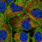 Immunofluorescent staining of human cell line CACO-2 shows localization to nuclear speckles, plasma membrane, cytosol & vesicles.